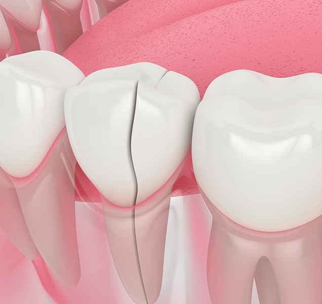 Restorative Dentistry | Harmony Family Dental Care | Springbank General and Family Dentist