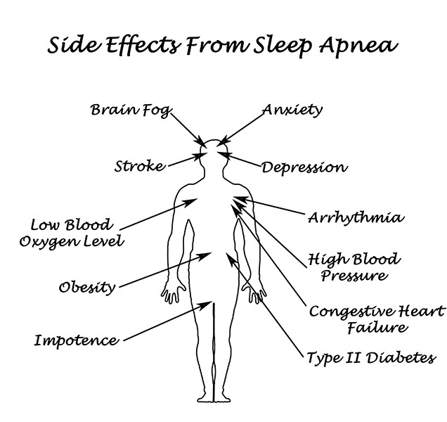Symptoms of Sleep Apnea | Harmony Family Dental Care | Springbank General and Family Dentist